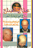 علاج الصلع؛ برنامج مميز لإعادة الشعر