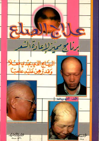 علاج الصلع ؛ برنامج مميز لإعادة الشعر