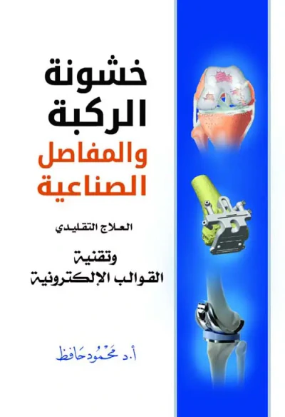 غلاف كتاب خشونة الركبة والمفاصل الصناعية " العلاج التقليدي وتقنية القوالب الإلكترونية "